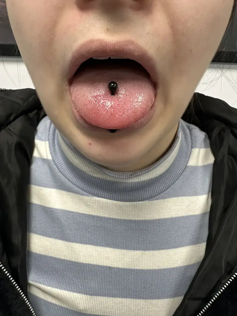 Fotografie piercing limbă din arhiva 2nd Face București
